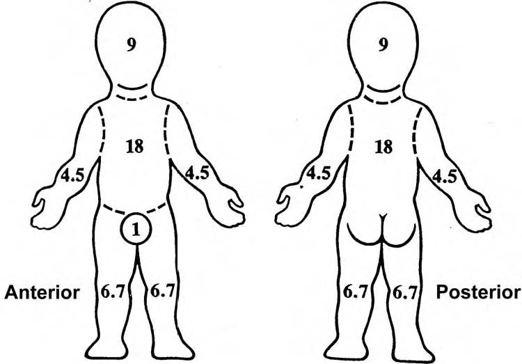 children burns Public Health Notes