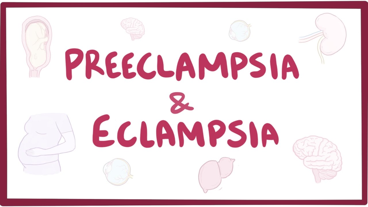 Pre eclampsia Eclampsia Causes Risk Factors Prevention Treatment 