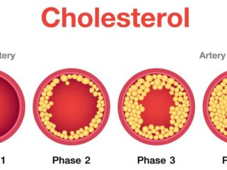 levels of cholesterol Archives - Public Health Notes
