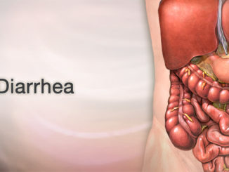 Diarrhea