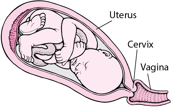 Labor during pregnancy