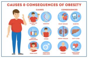 causes and consequences of obesity
