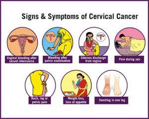 sign and symptoms of cervical cancer