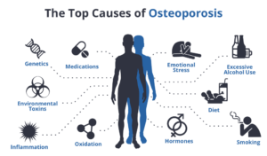 causes of osteoporosis