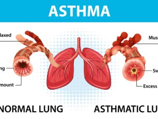 asthma lung