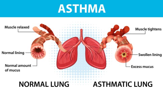 asthma lung