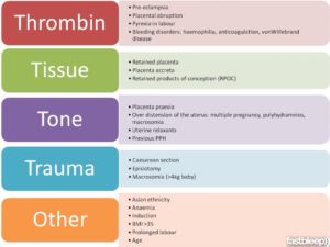 Causes of PPH